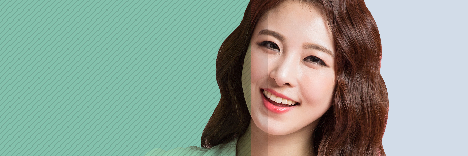 사각턱수술